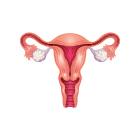 Women